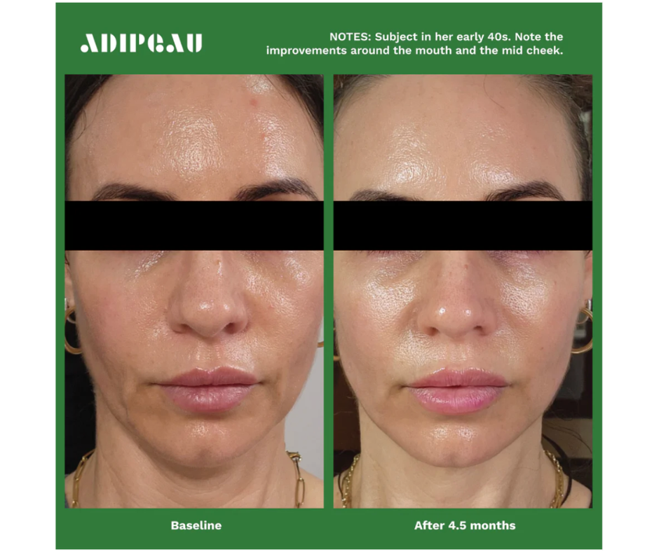 Adipeau Strength Gel