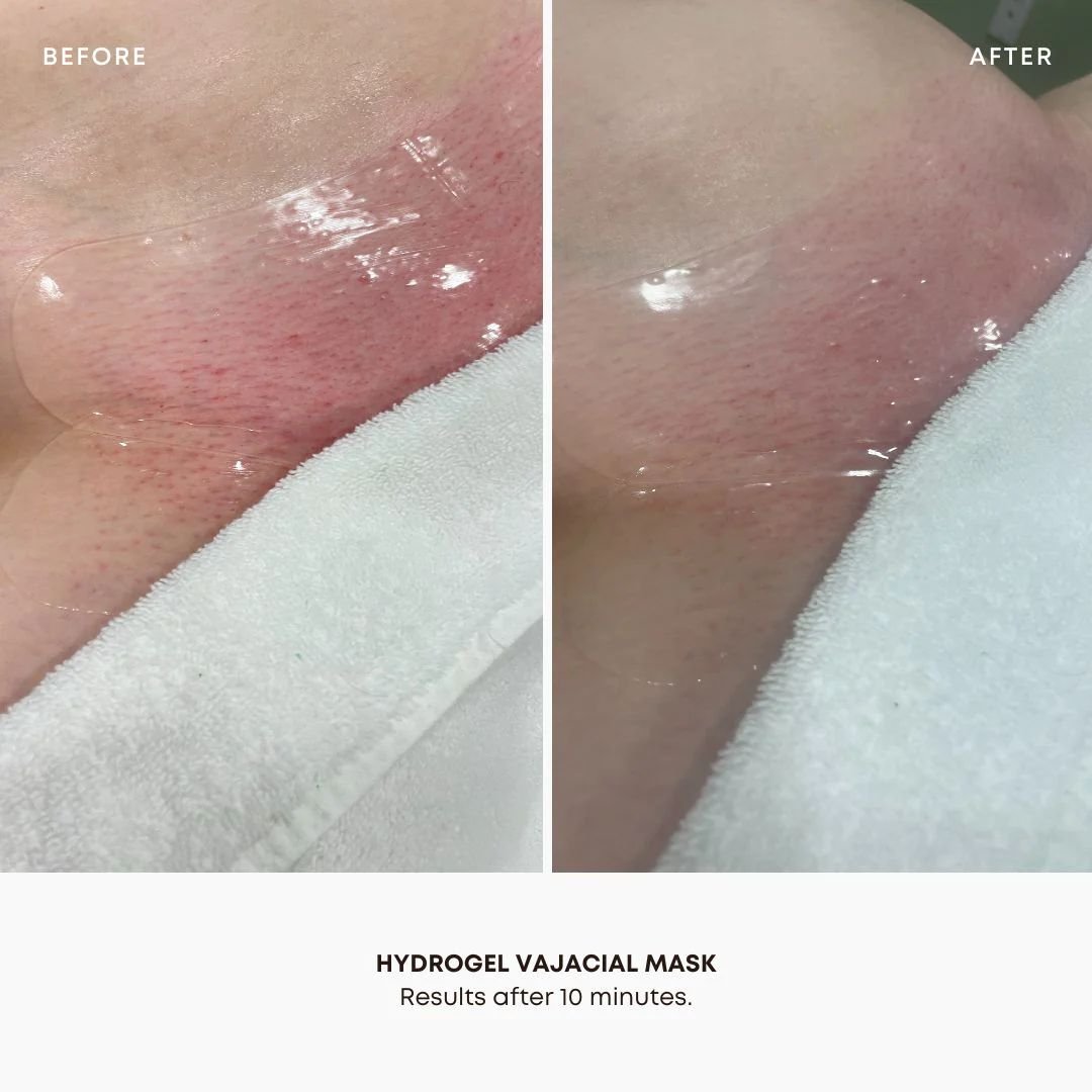Hydrogel Vajacial Products
